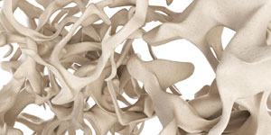 Osteoporose_Traditionelle_C